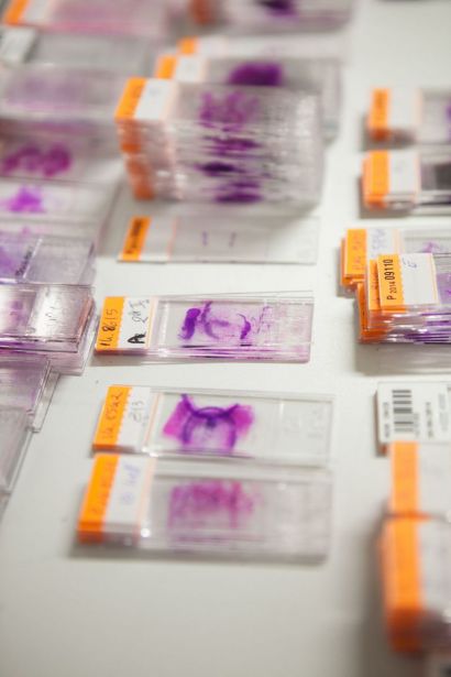 Photo prise au laboratoire d'anatomopathologie