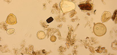 Grains de pollen grossis au microscope