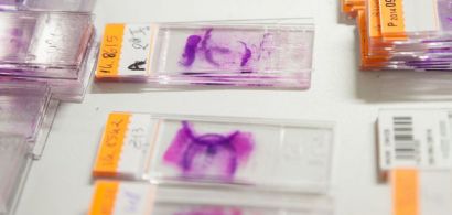 Photo prise au laboratoire d&#039;anatomopathologie