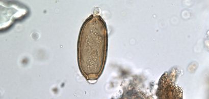 Photo de parasite au microscope