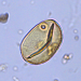 vue microscopique d'un pollen de céréale